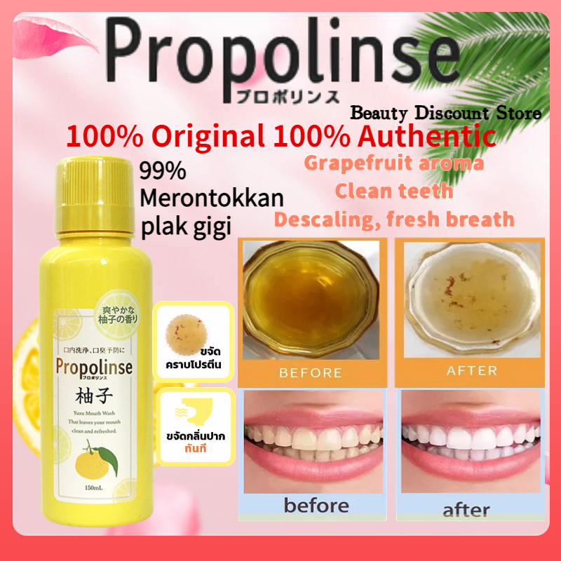 Propolinse Mouth Medicine Yuzu 150ml/Propolinse Mouth Medicine