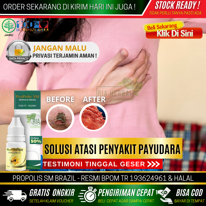 Medicine For Swallowing Breast Abscess, Ointment For Breast Ulcers