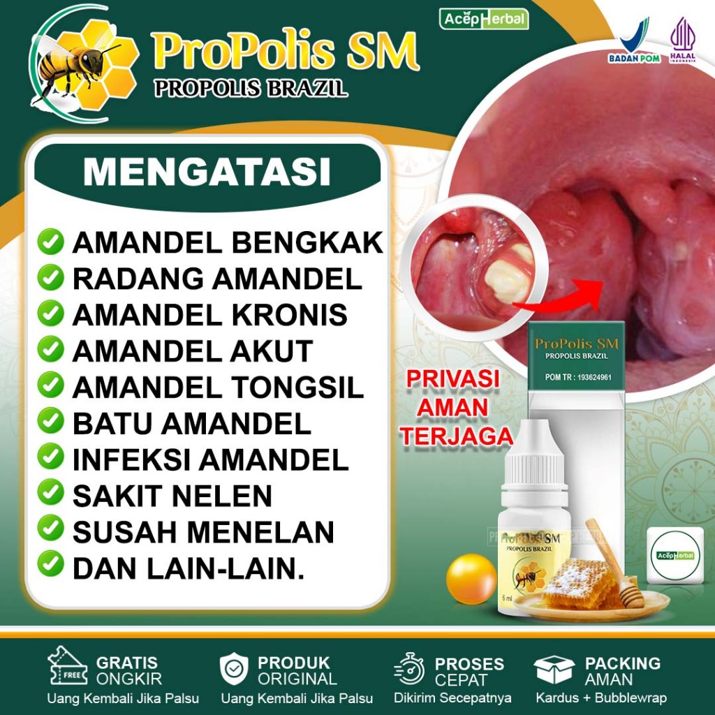 Drug For Children And Adults Swelling Tonsils Acute Tonsils Tongsil