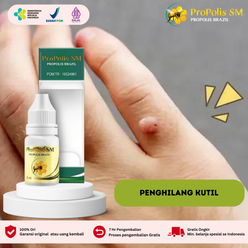 Medicine For Removing Warts, Removing Corals, Removing Warts On The ...