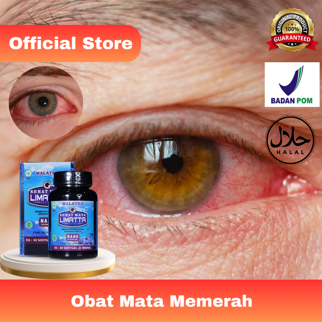 CAHAYA MATA Flushed Eye Medicine, Eye Pain Radiation Pain, Minus Eye ...