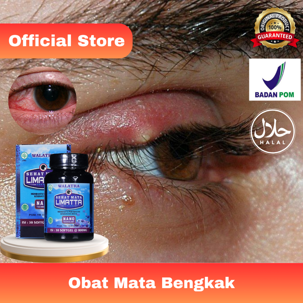 MERAH MATA Medication For Swelling Eyes, Cylindrical Eyes, Blurred