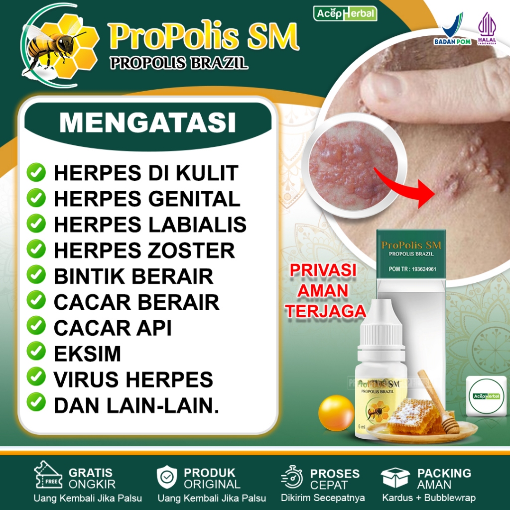 merah-medicine-for-genital-herpes-skin-herpes-herpes-zoster-red-spots