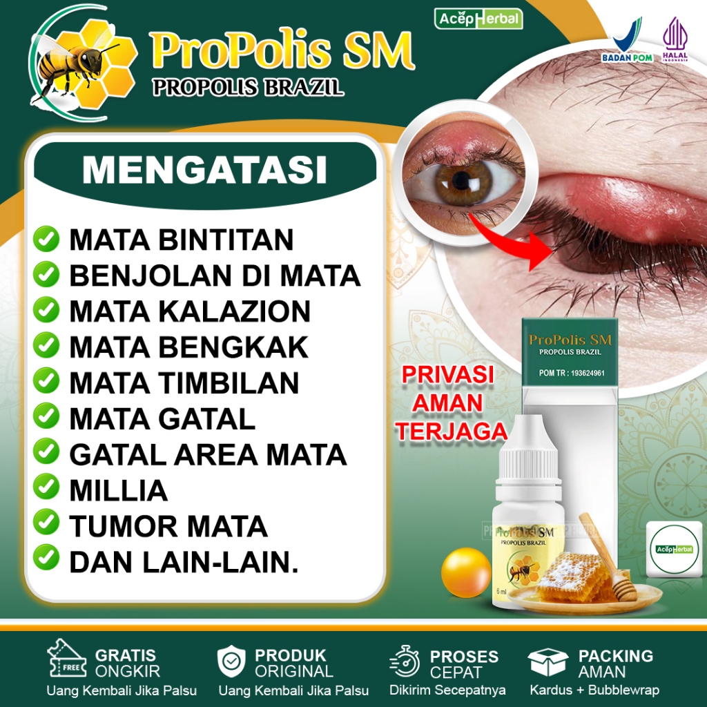 MATA Medicine For Eyes Bintitan Bumps On The Eyes Swelling Eyes