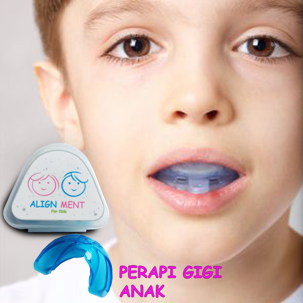 Original silicone children's dental braces, teeth leveling straightener ...