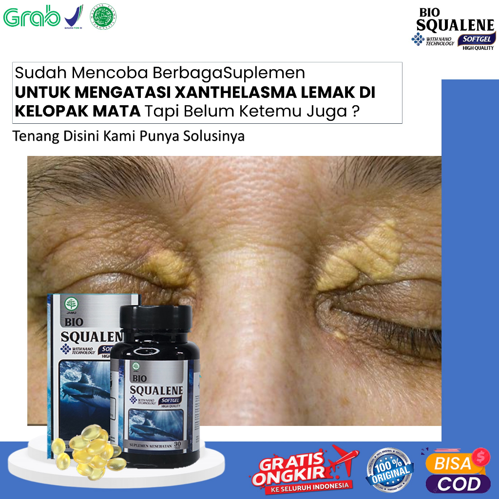 MATA Xanthelasma Medicine To Remove Fat Clobs On The Eyelids Yellow