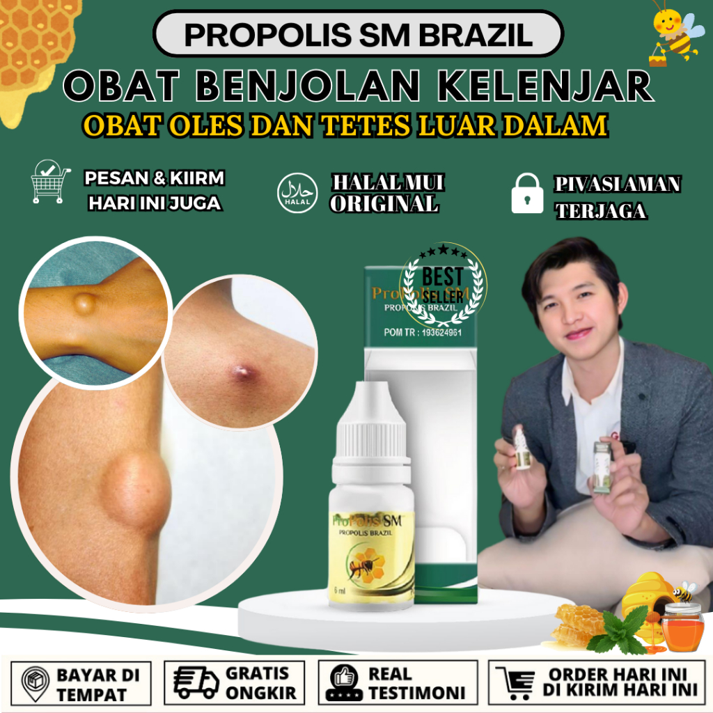 Topical medicine for lymph node lumps, thyroid Lipoma, lumps on the ...