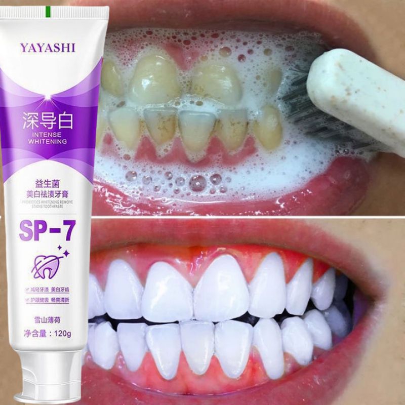 Whitening toothpaste SP-7 Probiotic Whitens Teeth Toothpaste 120g ...