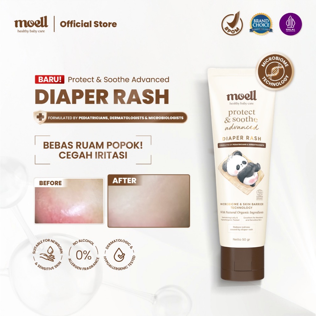 Moell Diaper Rash Advanced 50g - Cream Relieves and Prevent Rashes ...