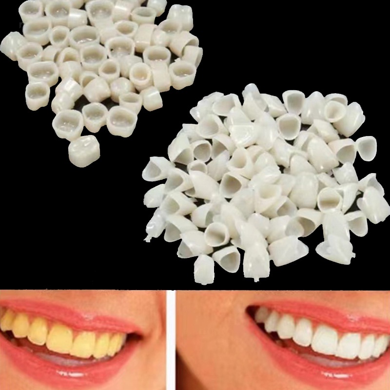 120pcs (50 Molar + 70 Anterior ) Dental Teeth Veneers Temporary Crown