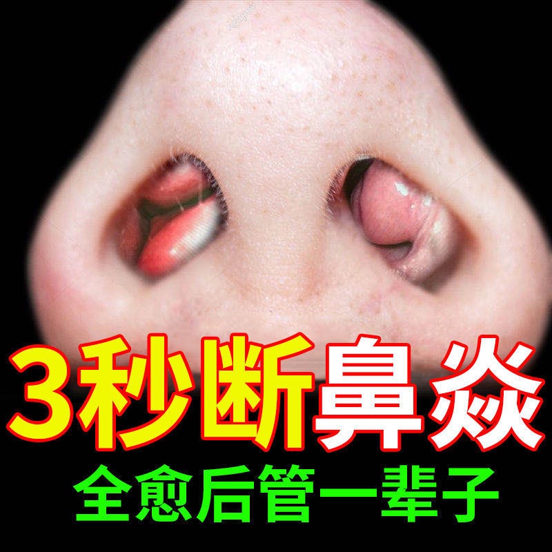 Strong Pure Chinese Medicine Nasal Ning Cream Sinus Inflammation Nose