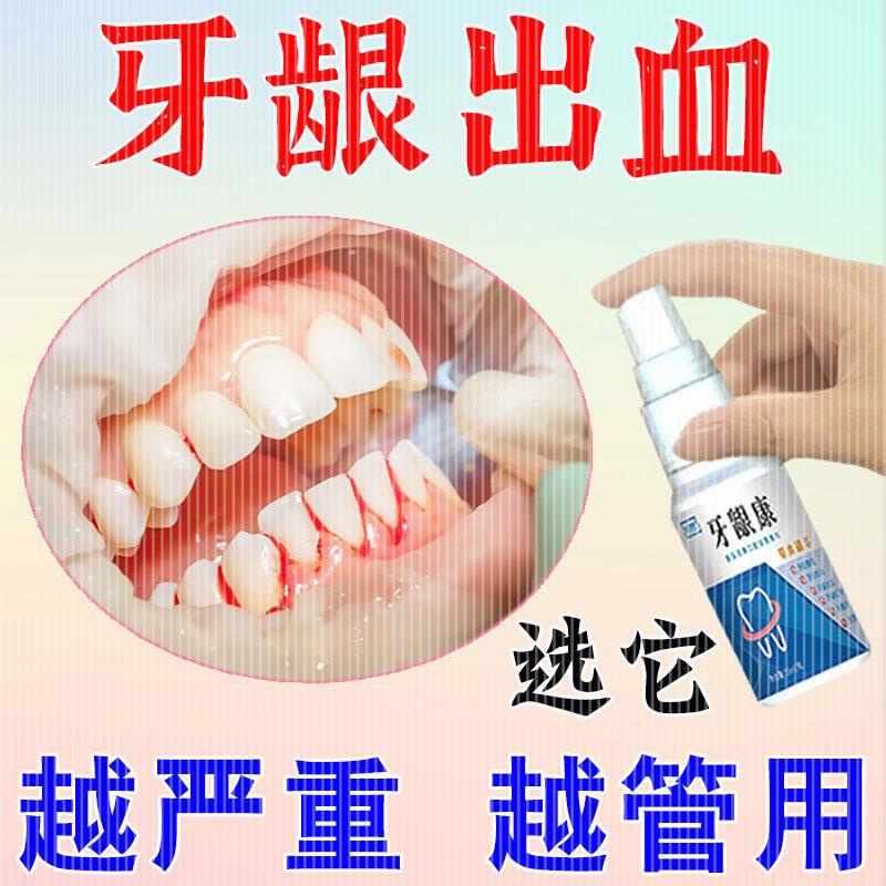 Gum bleeding hemostatic spray for bleeding teeth, sensitive Gum