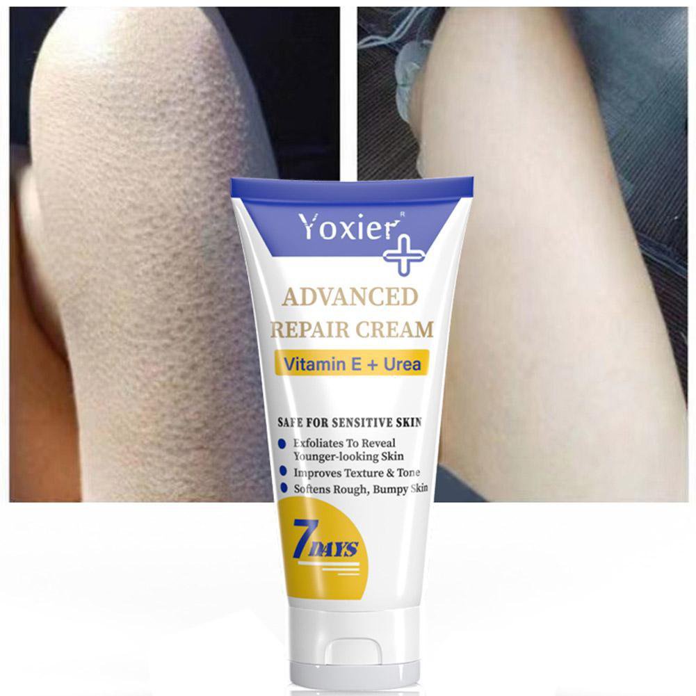 G Curing Keratosis Pilar Repair Cream Remove Chicken Skin Dark Spots Moisturizing Smooth Pores