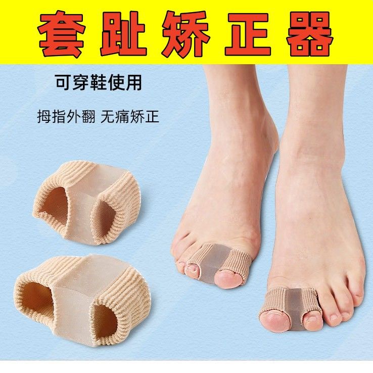 Thigh bone outstanding toe, great toe head orthotics deformation points