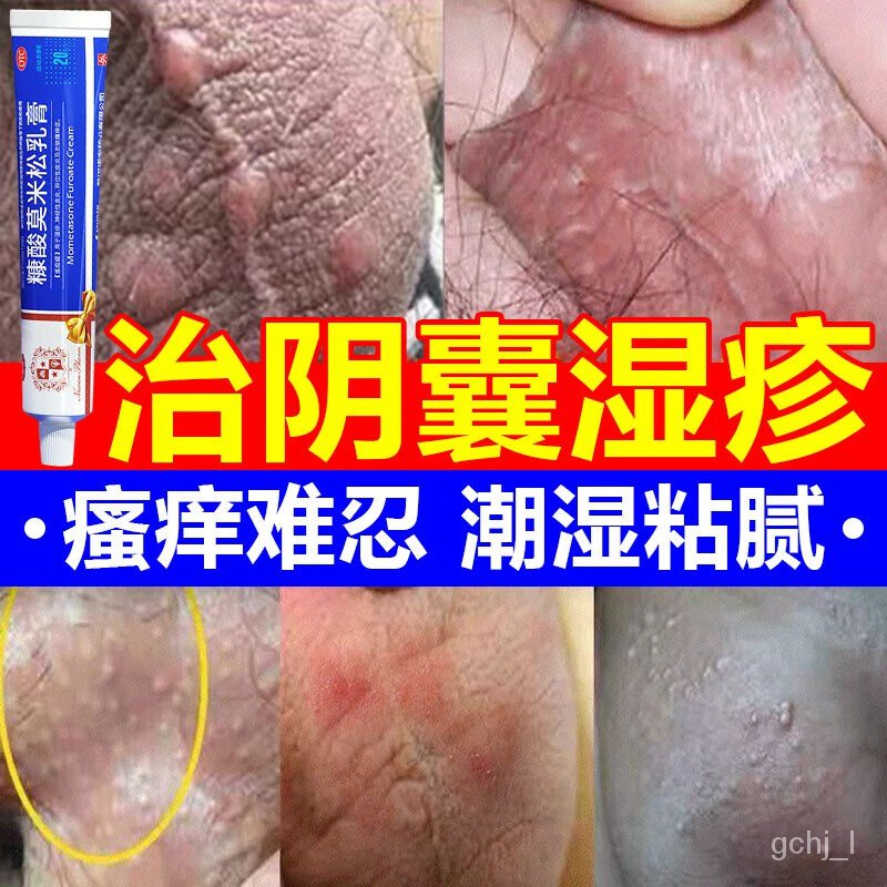 KYJD Mometone Furoate Cream Wet Scrotum Itching Special Purpose