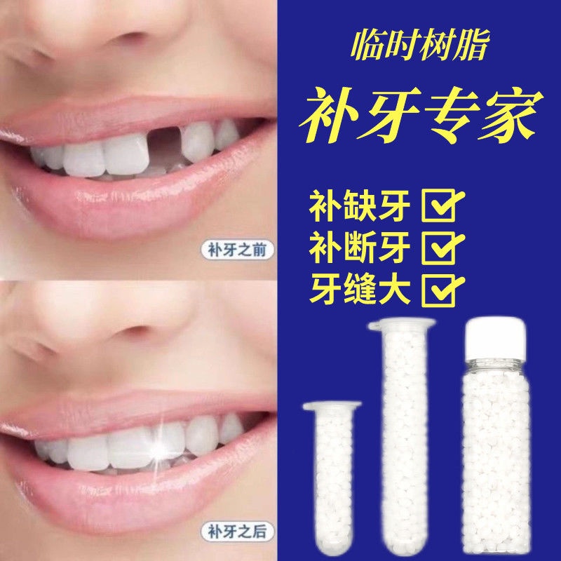 Temporary Denture Resin Fill Your Own Fill Teeth Missing Teeth Door