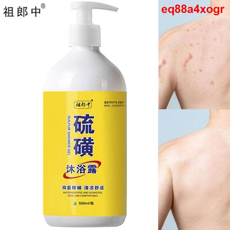 Sulfur Ointment Scabies Mites Fat Body Wash Lotion Bath Skin Care