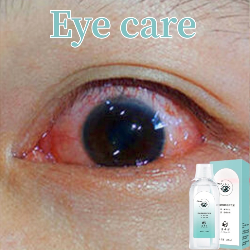 Medical eye wash Eye cleaner Eye care Suitable for bloodshot dry eyes