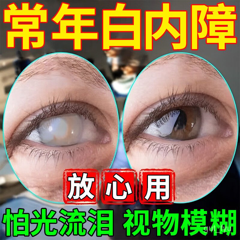 KYJD Cataract Eye Drops Elderly MiddleAged and Elderly Eyes Can't See