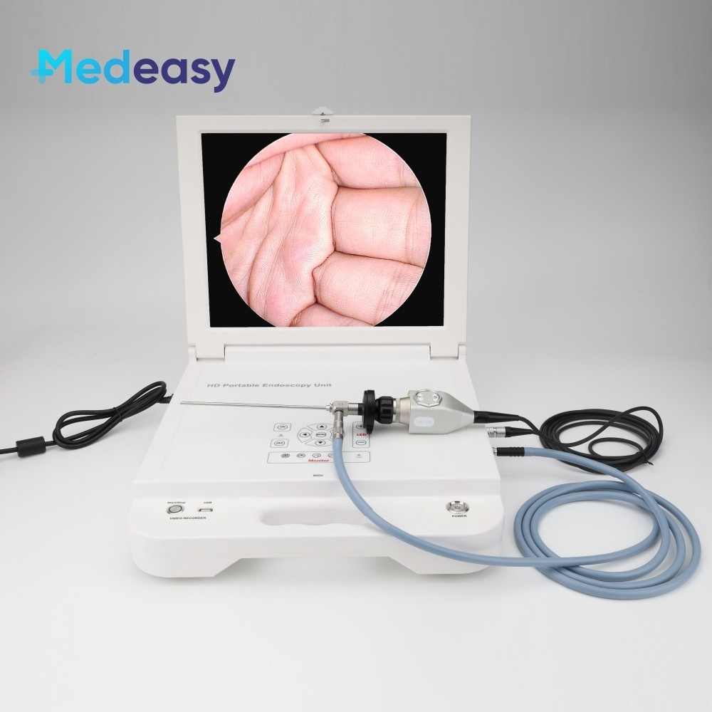 Portable Full HD Endoscope Camera Unit, Endoscopy Camera System with 17 ...