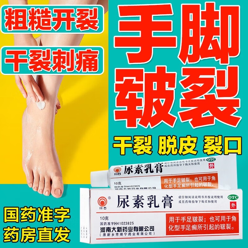 Urea cream Treatment of Chapped Hands and Feet Keratotic Tinea Hand Or