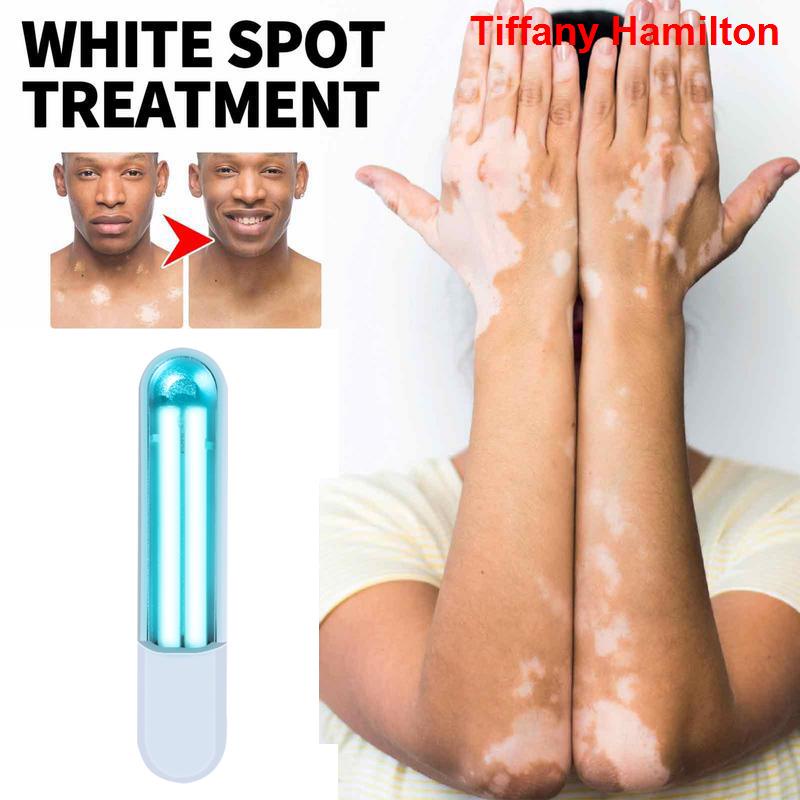 Manufacture 311 Nm Uvb Lamp For Vitiligo Uvb Phototherapy Uv Light