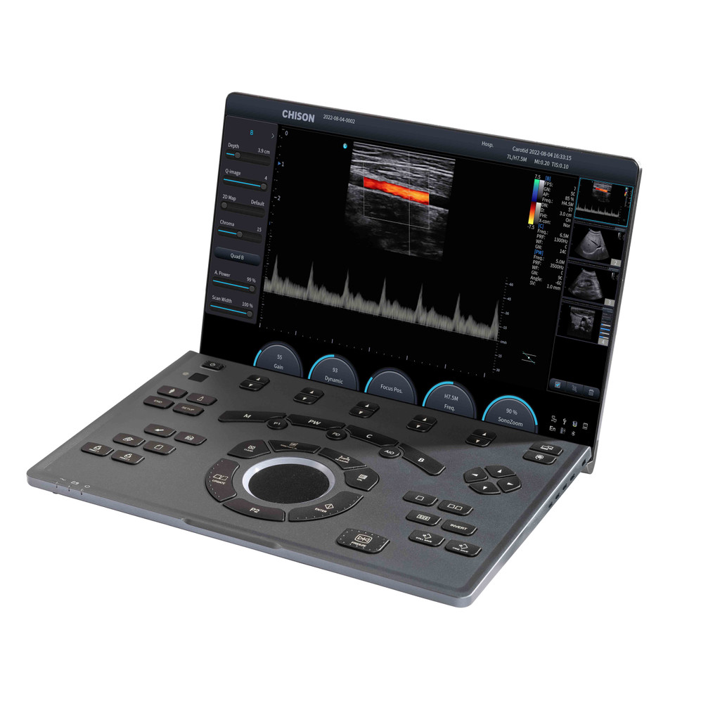 Mid-range and high-end Portable Digital Color Doppler Ultrasound ...