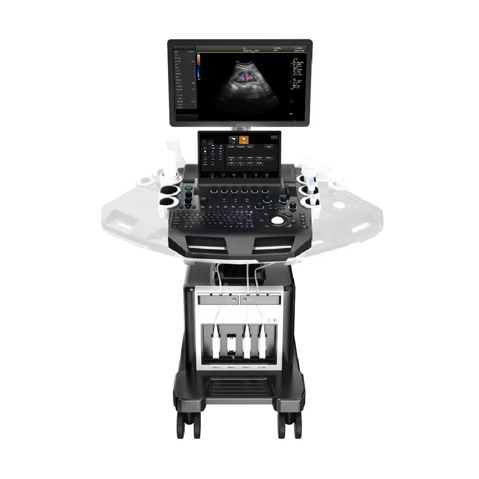 21.5 Inch Large Screen 13.3 Inch Touch Screen Color Doppler Ultrasound ...