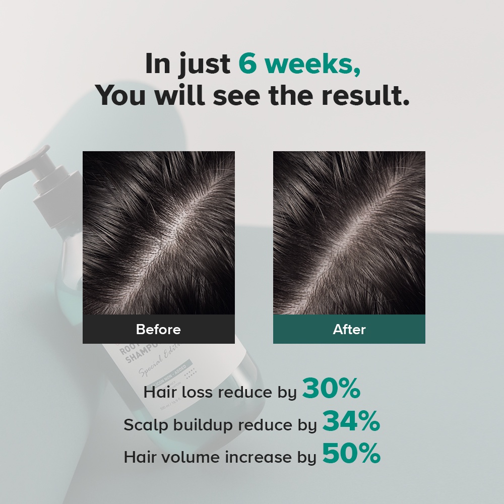 [GRAFEN] Premium Scalp Care Set (Root Booster Shampoo 500ml + Scalp