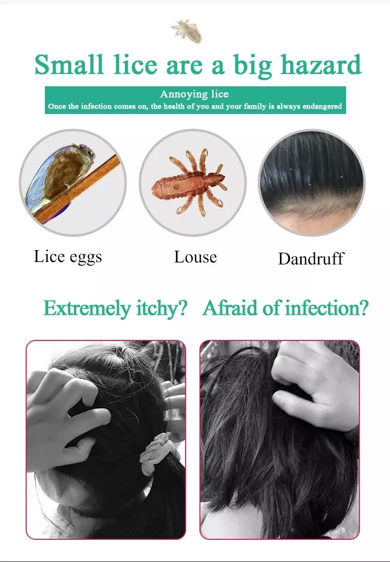 Y48 Farewell To Lice Disorder] CHONGXIN Lice Comb Easily Removes Lice ...