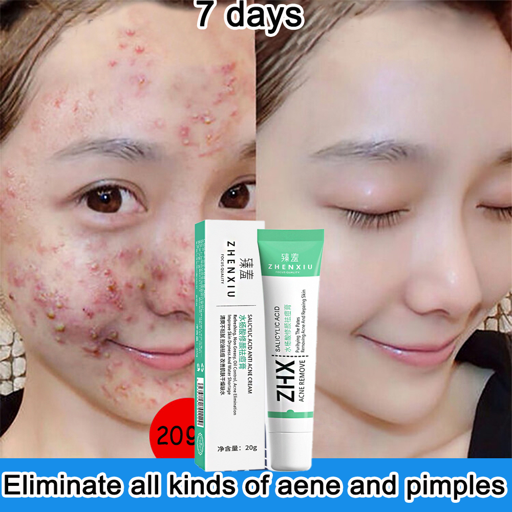 Dermatix Advanced Scar Formula Acne Scar Cream Keloid Scar Remover Krim