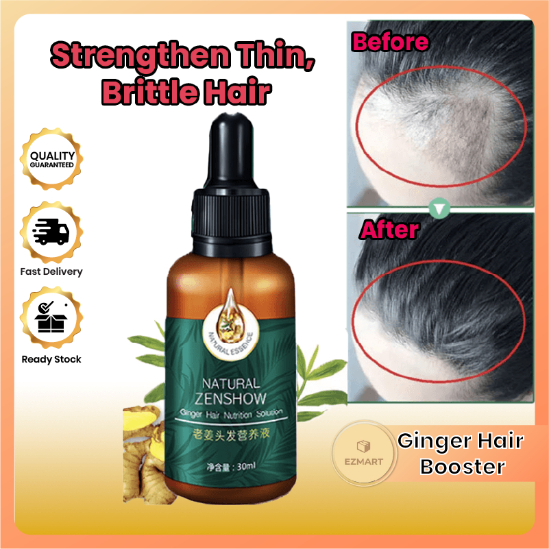Ginger King Hair Growth Serum Ginger Hair Growth Tonic Tumbuh Rambut