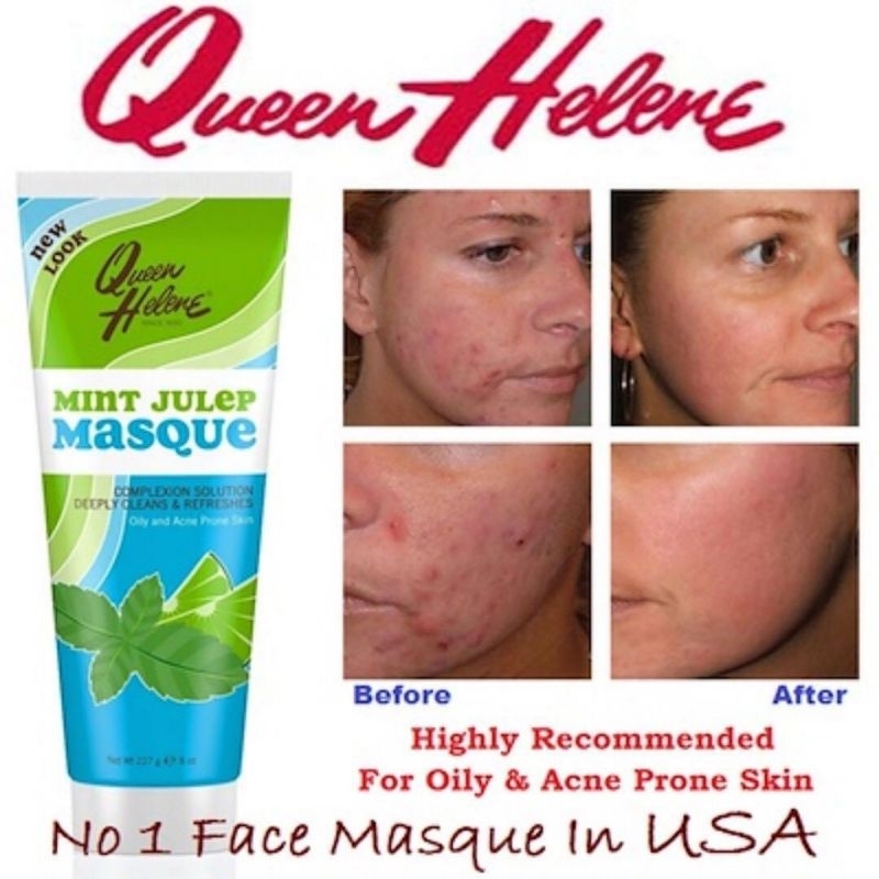 Mint Julep Masque 8 oz 227g Net Shopee Malaysia