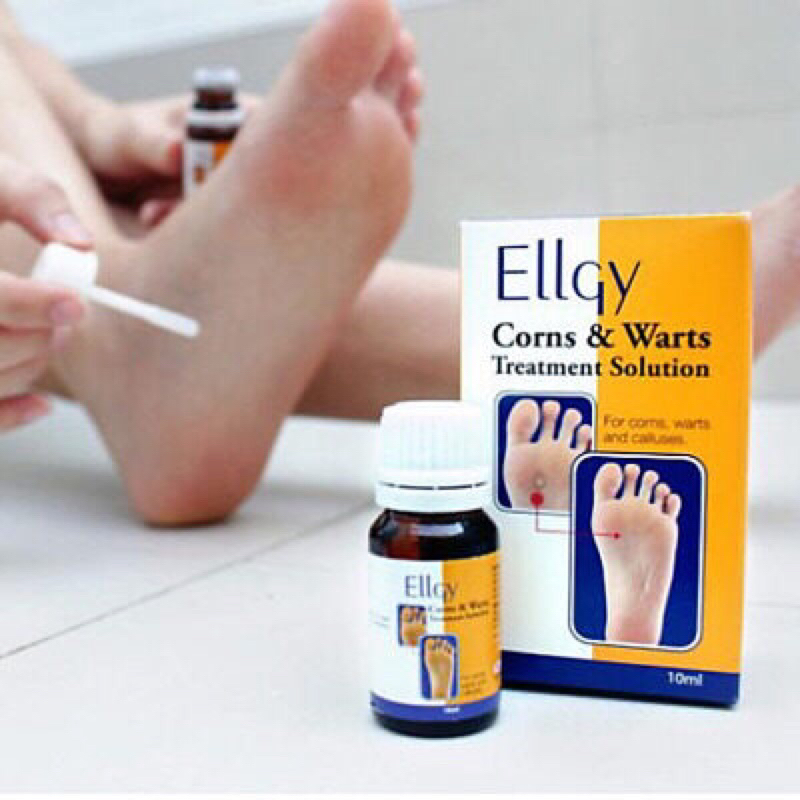 Ellgy corns & warts treatment solution 10ml | Shopee Malaysia