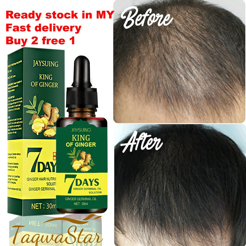 2in1 Neo Hair Lotion 100 Original 120ml Hair Spray Hair Transplant and