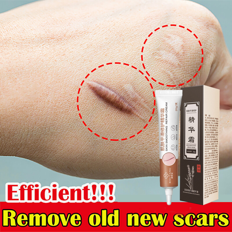 Acne Scar Removal Cream Treatment Remove Stretch Marks acne scar serum