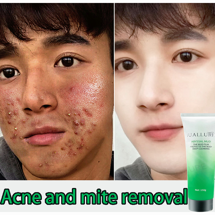 IUALLURE Deep sea mud Antiacne facial cleanser Face Wash Control