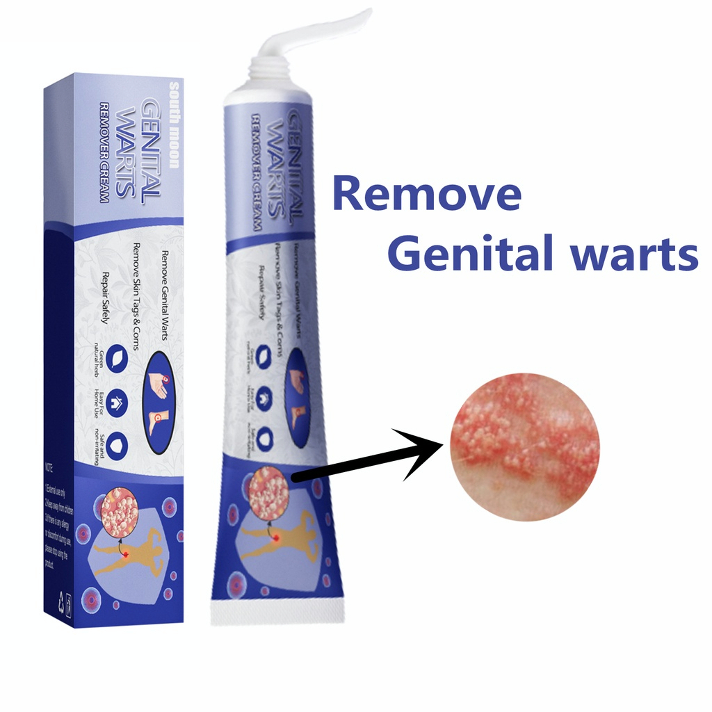 Ubat ketuat kelamin Kutil kelamin removal Genital warts removal cream