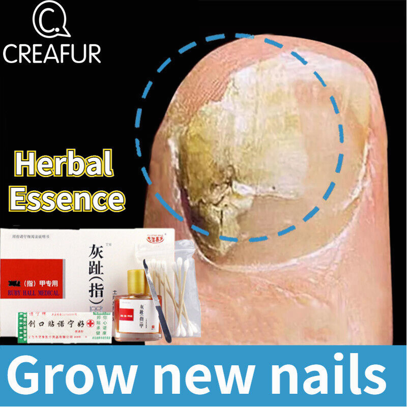 Nail Fungal Treatment NAIL REPAIR CREAM 25ml Nail Foot Whitening Toe