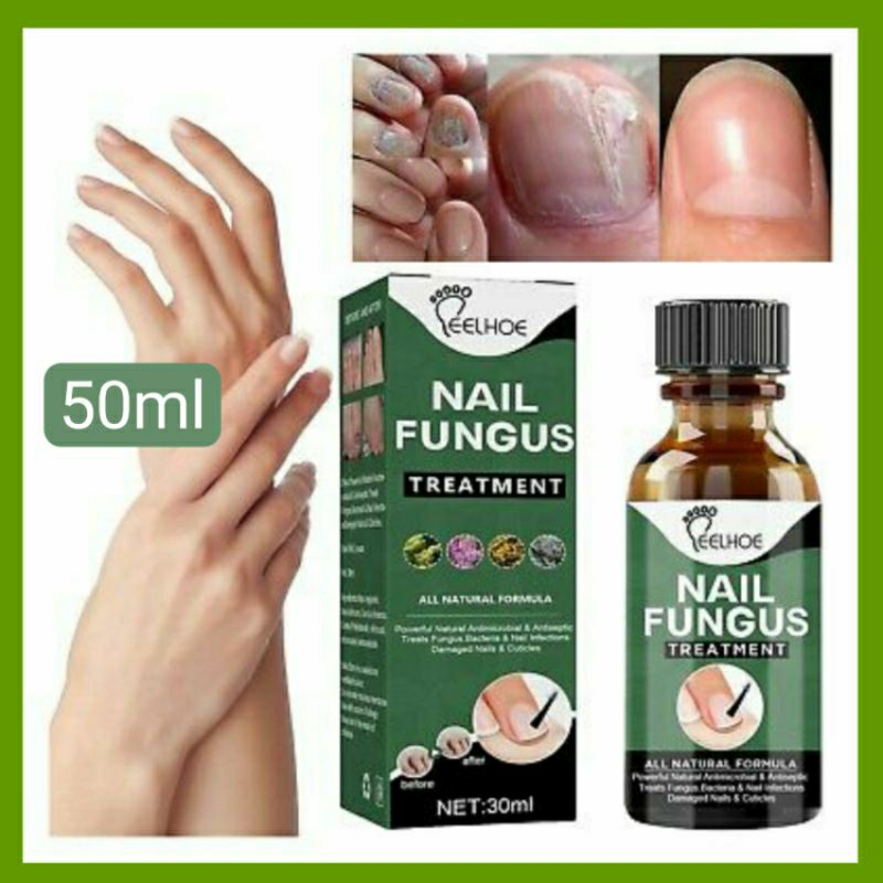 50ml Eelhoe Ubat Kuku rosak / Penawar fungus kuku / Nail repair ...