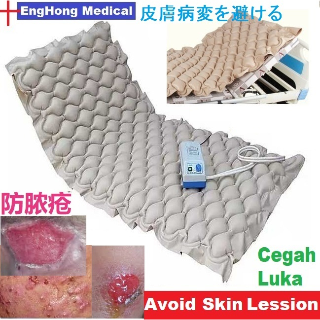 EngHong Ripple Mattress Air Mattress Hospital bed, Medical Bed, Avoid