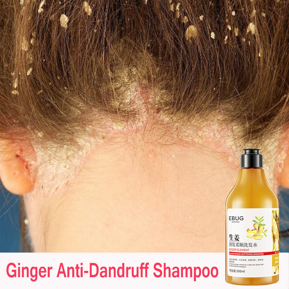 Kelemumur Ginger Shampoo Rambut Gugur Dan Kele Anti Dandruff Ginger