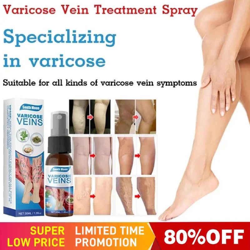 South Moon Varicose veins spray AND BONE PAIN RELIEF COLD COMPRESS GEL