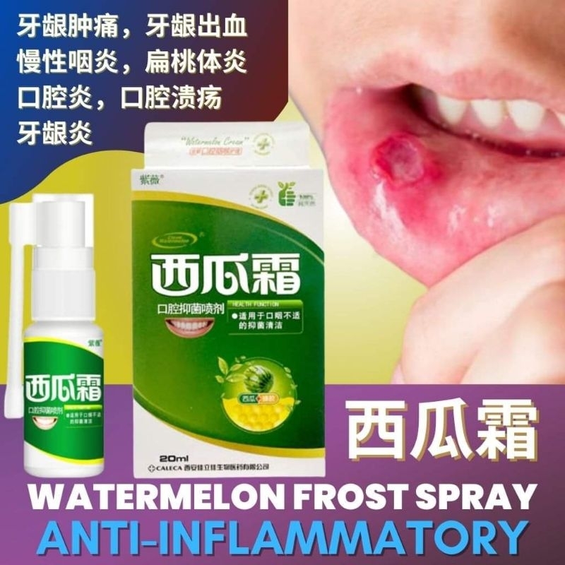 西瓜霜喷剂 watermelon frost spray 20ml mouth spray tooth aches mouth ulcers Sore throat relief 口腔溃疡喷剂