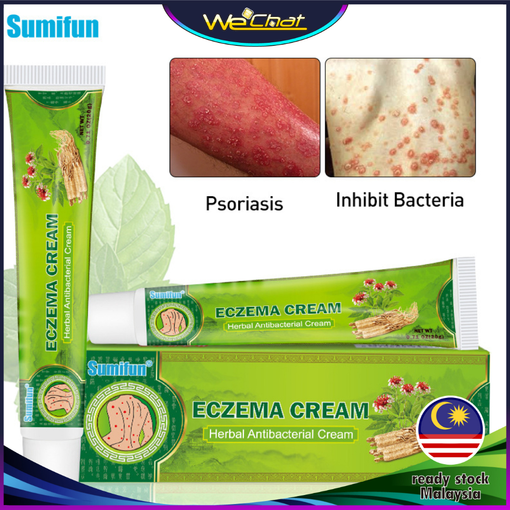 1pc 100 Sumifun湿毒清软膏Eczema cream Ubat ekzema berkesan Krim gatal