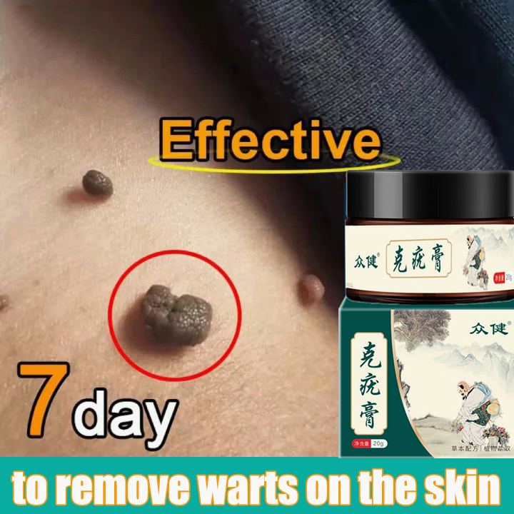 wart cream Genital warts herpes 20g wart ointment to remove acute moles