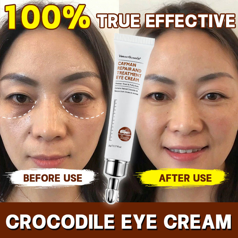 Retinol Infused Eyebag Remover Cream - Say Goodbye to Dark Circles ...