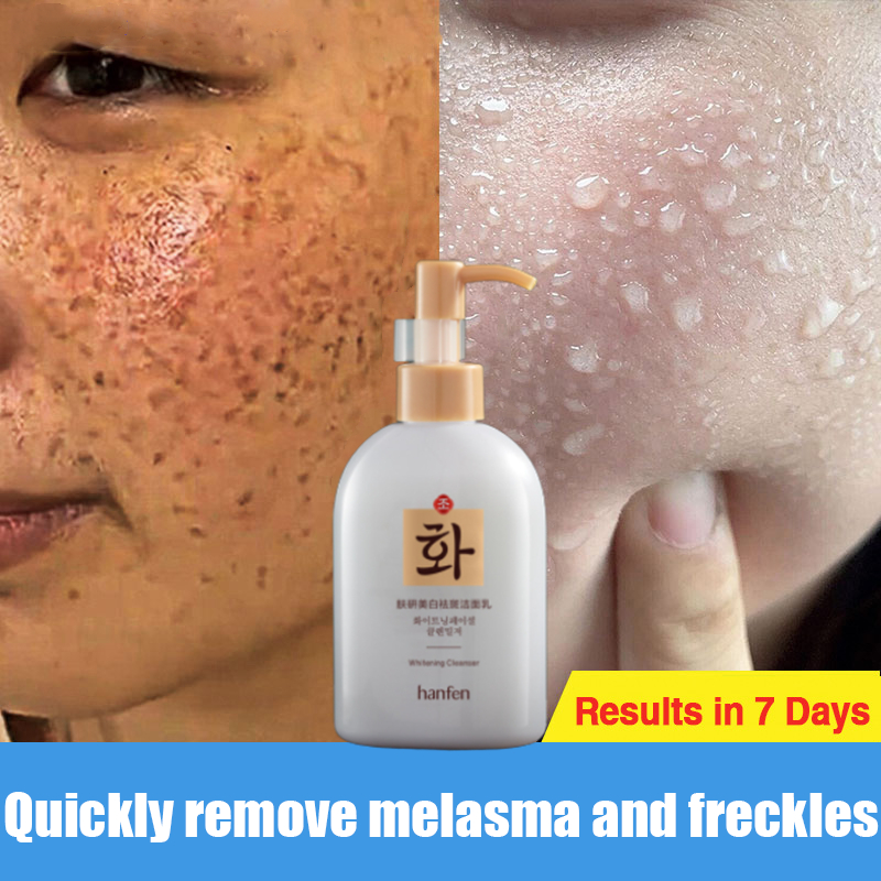 Whitening Freckle Cleanser jeragat paling berkesan menghilangkan flek