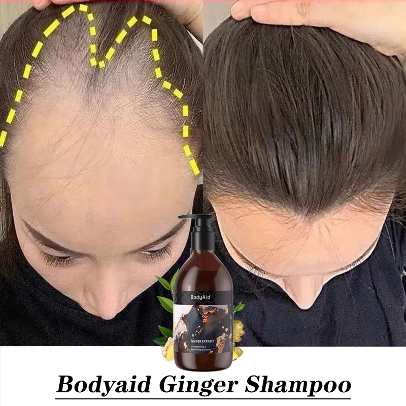 💯 Original Bodyaid Ginger Extract Shampoo 300ml Anti Hair Fall Shampoo Hair Growth Hair 5585