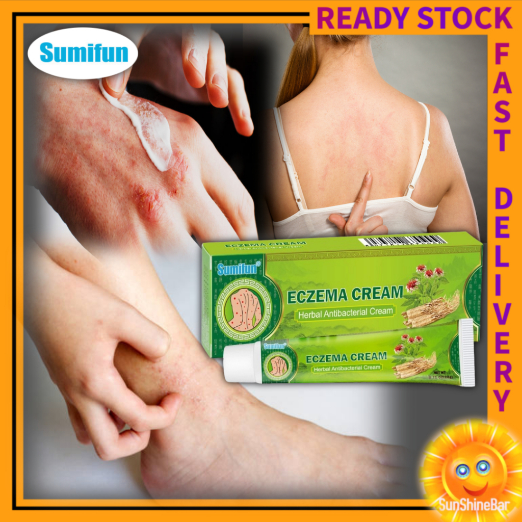 Eczema Cream Psoriasis Sumifun Itchy Skin Antibacterial Antifungal Krim